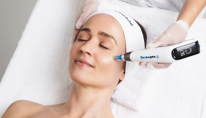 Dermapen Microneedling