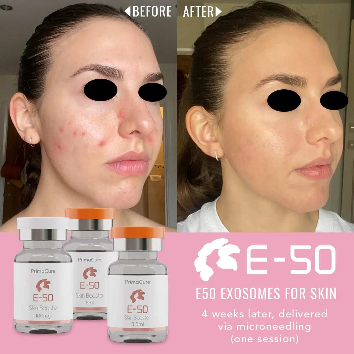 E-50 Skin Booster