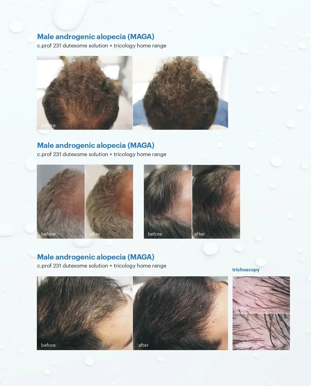 After and before Cosmelan and Dermamelon showing results